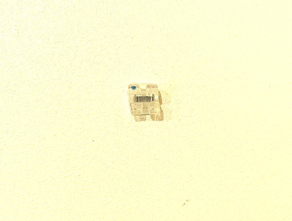 プラスチックブラケット